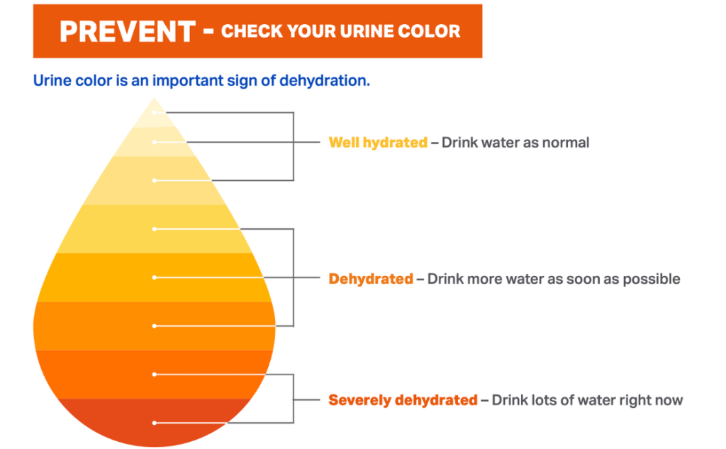 Urine color chart showing hydration levels, from light yellow (well hydrated) to dark orange (severely dehydrated), with guidance to drink water accordingly.
